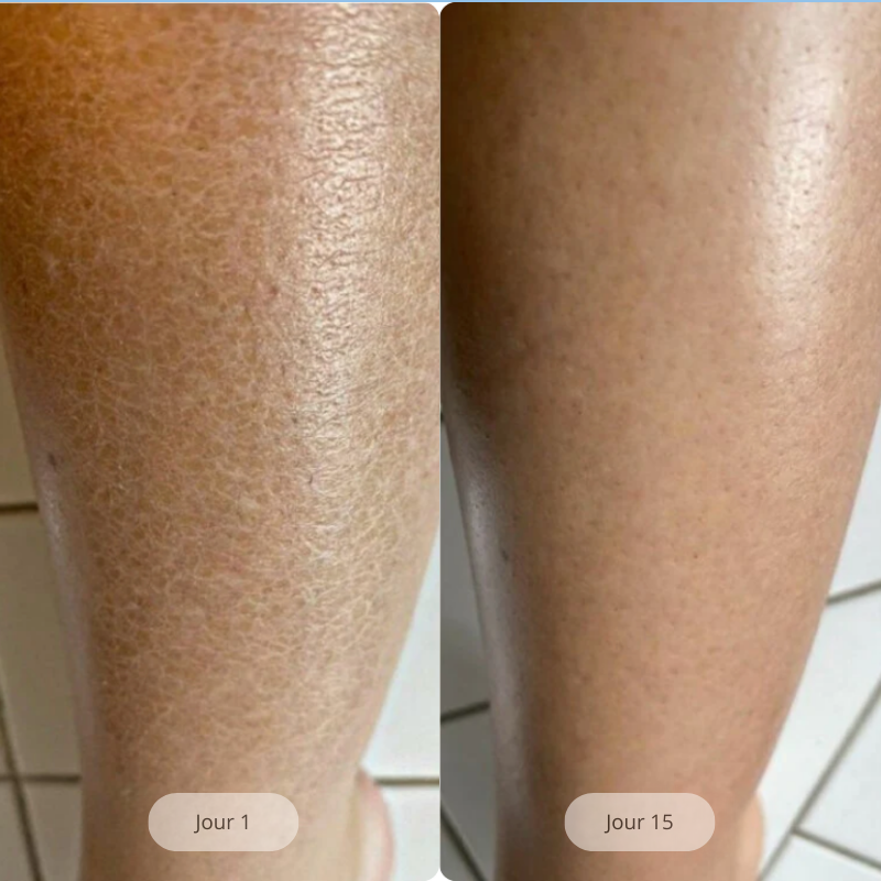 Vaéna - Blissal Pure®